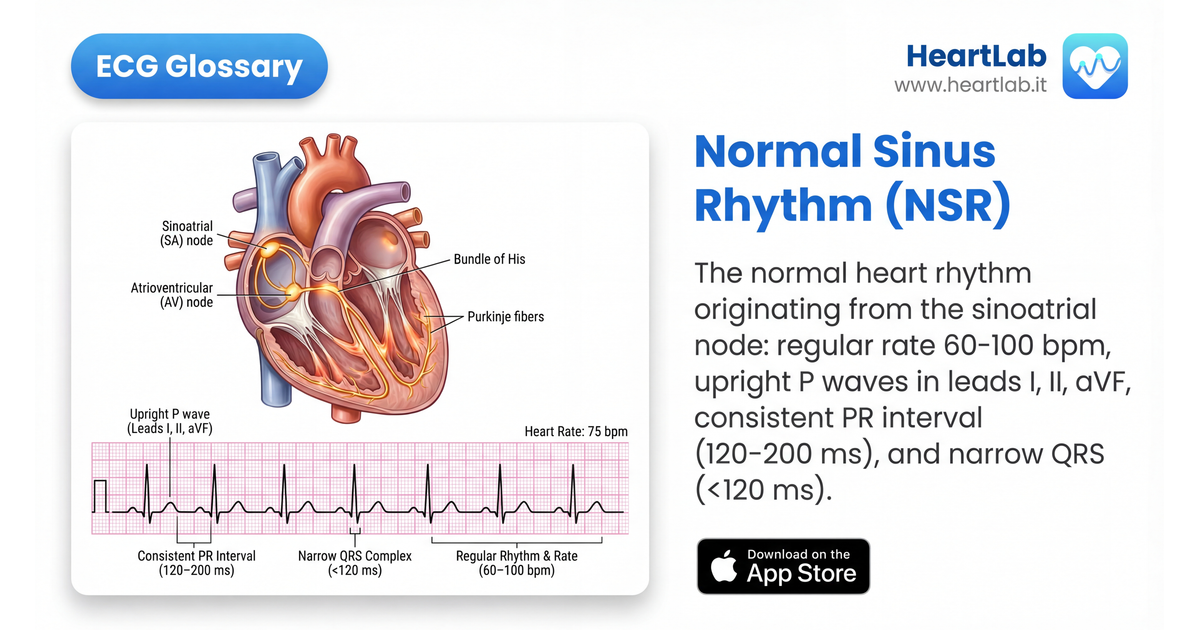 Glosario ECG — Términos del Electrocardiograma de la A a la Z | HeartLab